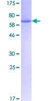 12.5% SDS-PAGE Stained with Coomassie Blue.